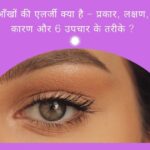 Eye Allergies । आँखों की एलर्जी क्या है  प्रकार, लक्षण, कारण और 6 उपचार के तरीके ।